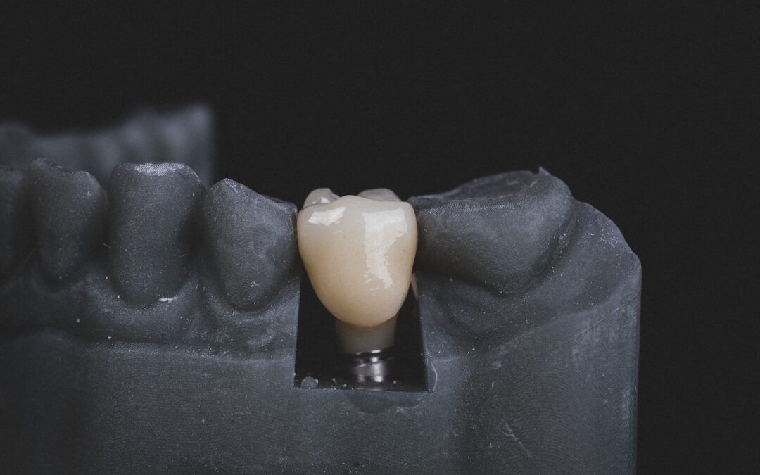 Low-Cost High-Quality: Aidite’s 3D Printing Technology for Every Practice